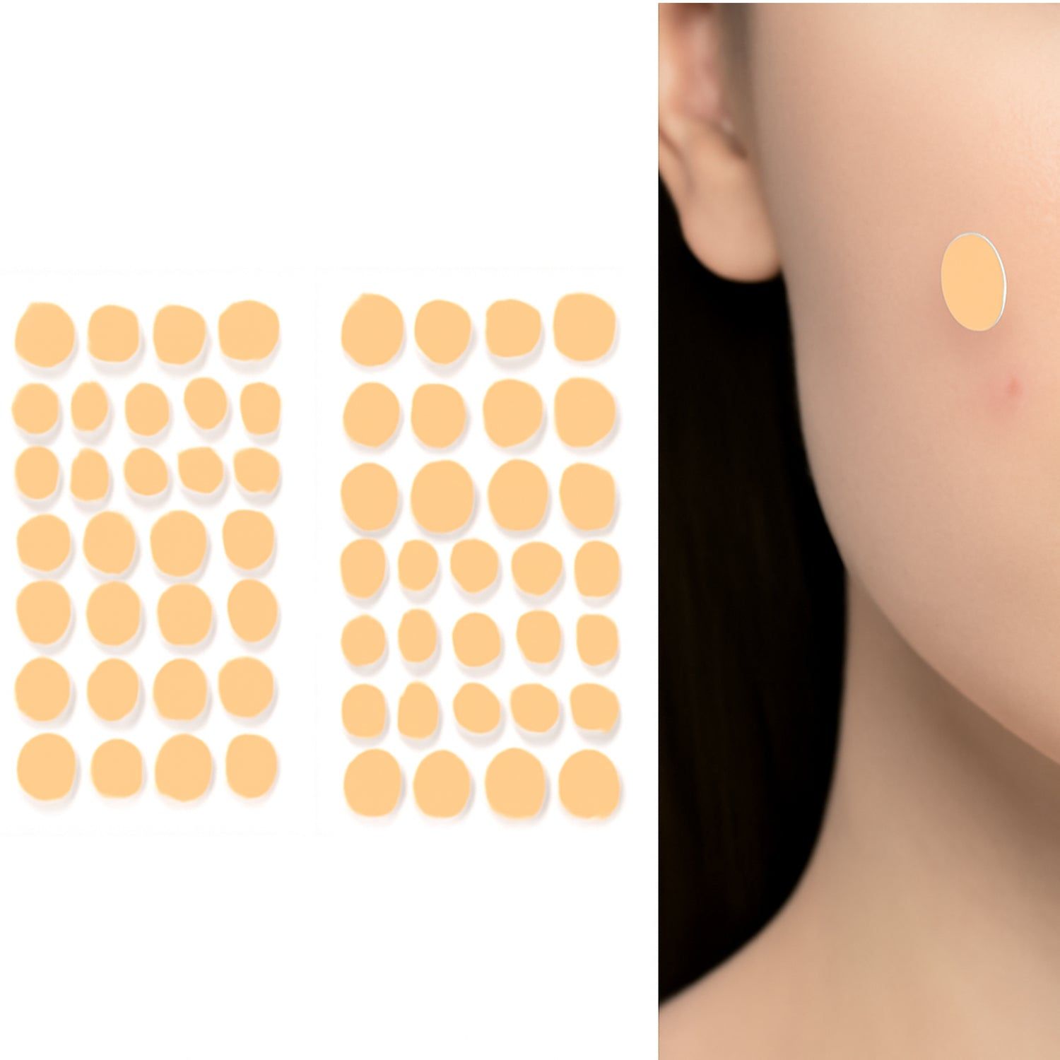 Pimple Patches for Face (1 Sheet Set)